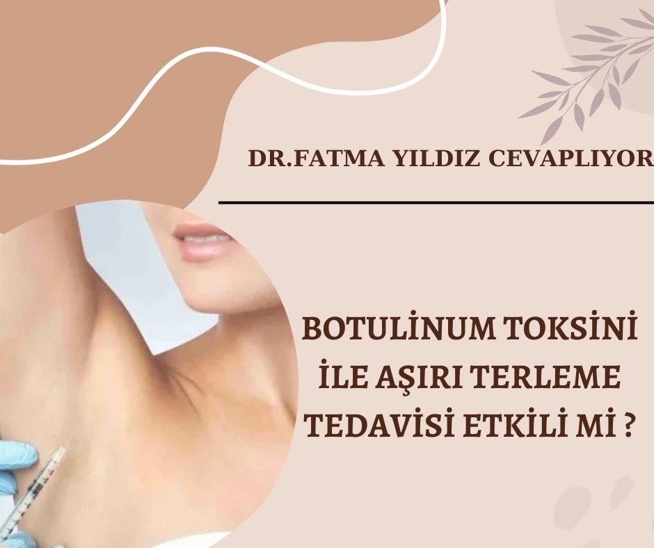 Botulinum /Toksini/ ile /Aşırı /Terleme /Tedavisi /Etkili Mi ?