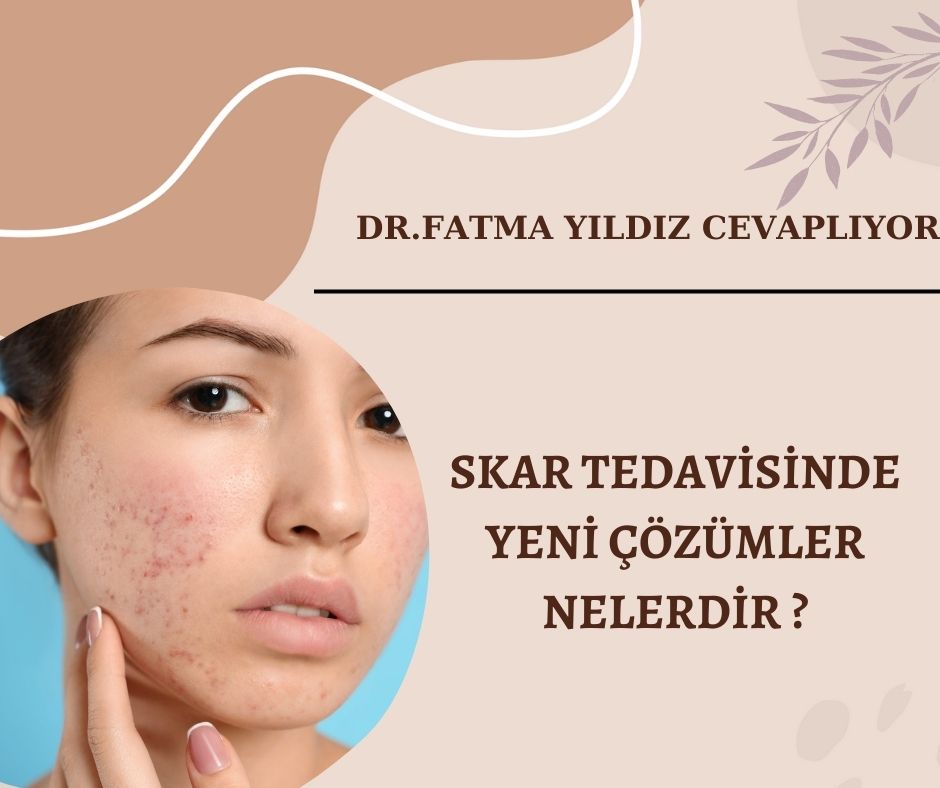 Skar-tedavisinde-yeni-çözümler -nelerdir ?