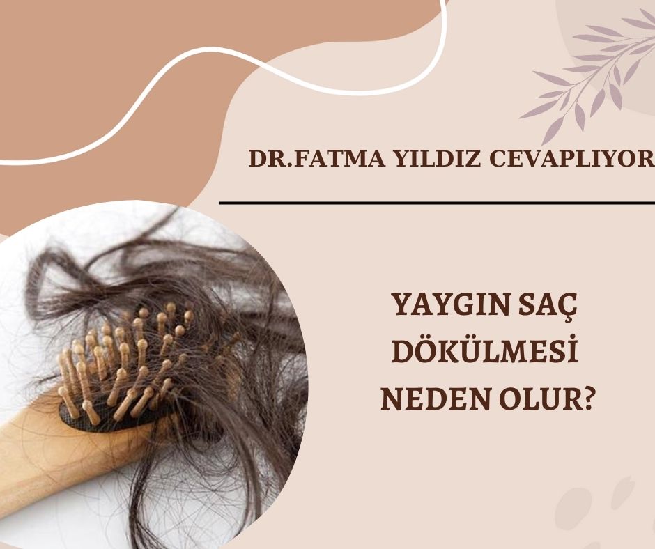 Yaygın-saç-dökülmesi-neden-olur?