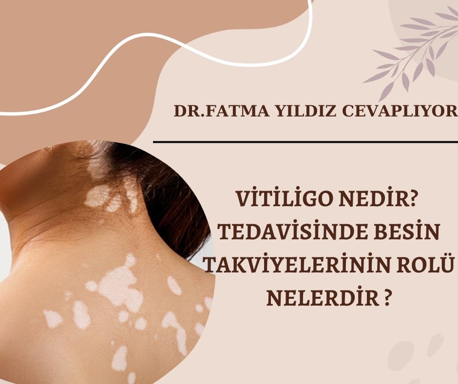 Vitiligo-nedir? -Tedavisinde-besin-takviyelerinin-rolü-nelerdir-?