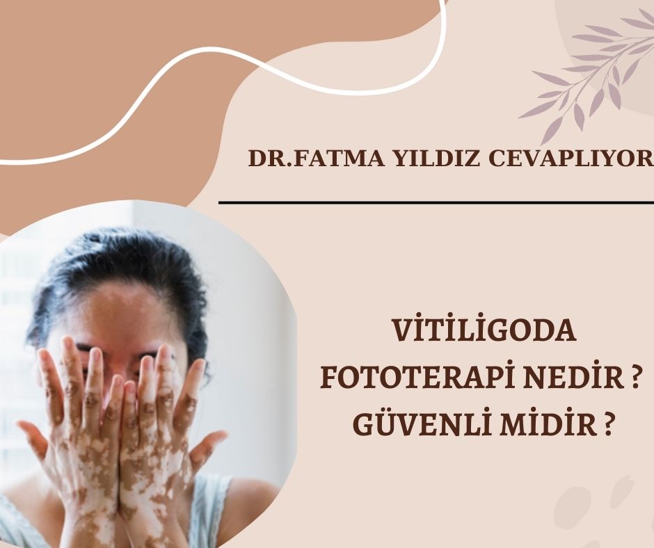 Vitiligoda-fototerapi-nedir-?-Güvenli-midir ?