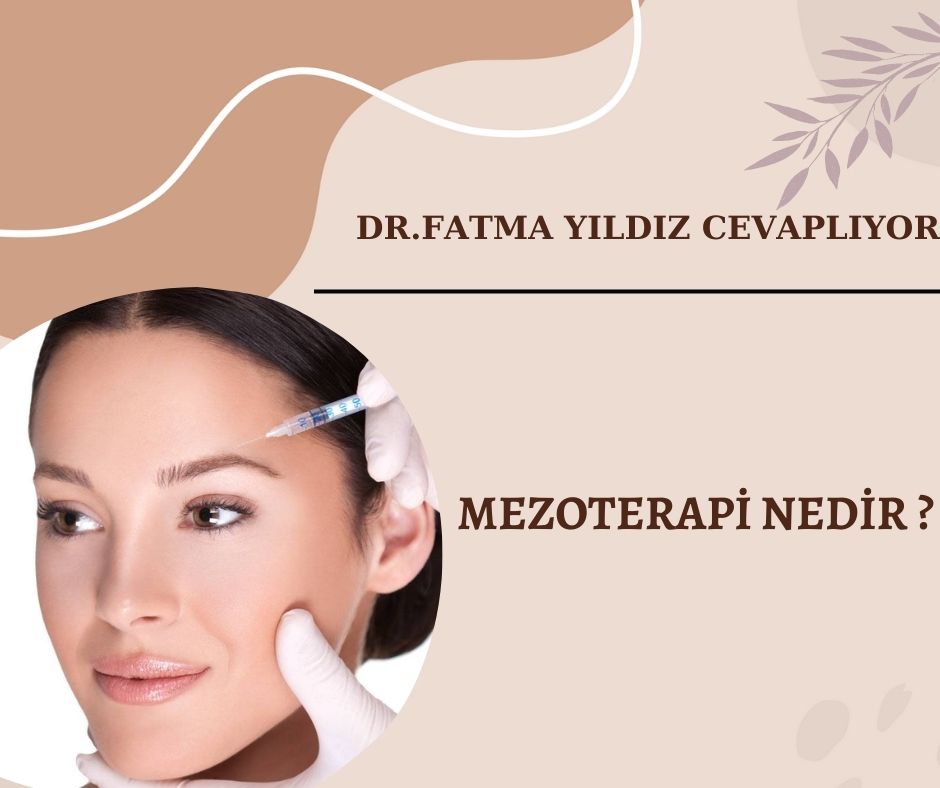 Mezoterapi-nedir-?