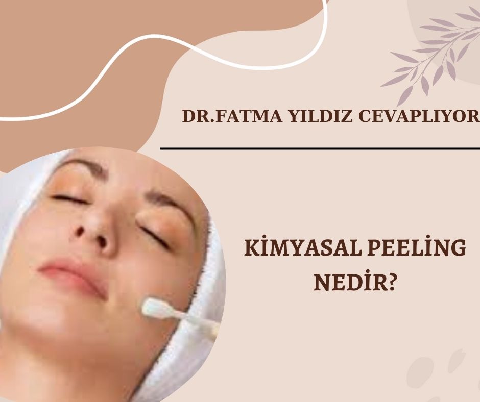 Kimyasal-peeling-nedir?