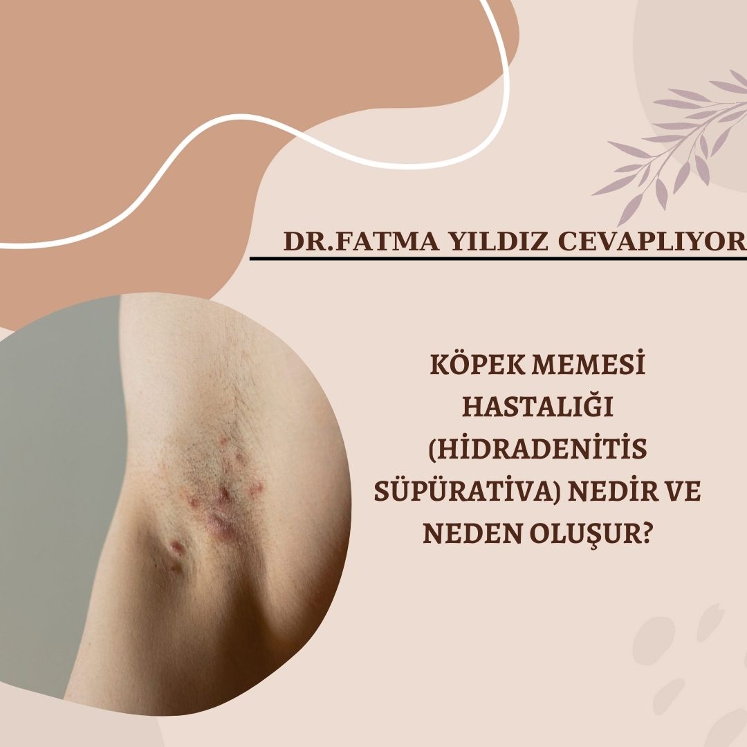 Köpek/ Memesi/ Hastalığı /(HİDRADENİTİZ Süpürativa) Nedir/ Nasıl Oluşur?