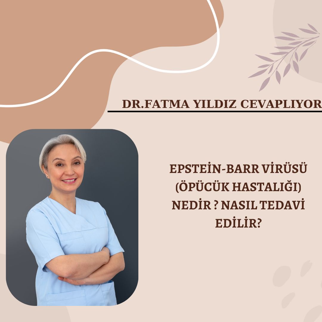 EPSTEİN-BARR/VİRÜSÜ/ (ÖPÜCÜK HASTALIĞI)/ NEDİR ? NASIL TEDAVİ EDİLİR?