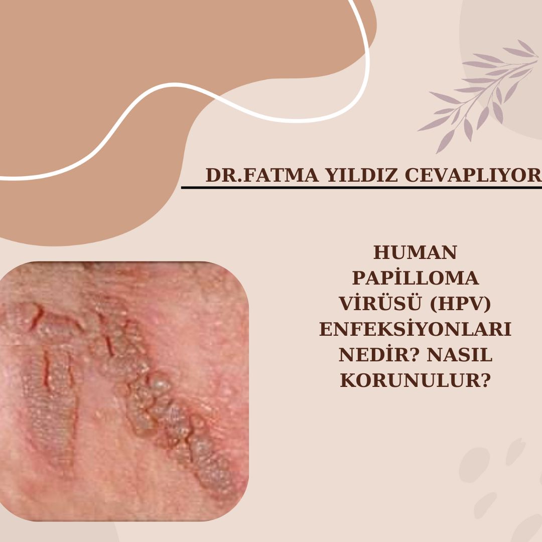 HUMAN /PAPİLLOMA /VİRÜSÜ (HPV) /ENFEKSİYONLARI /NEDİR? NASIL KORUNULUR?