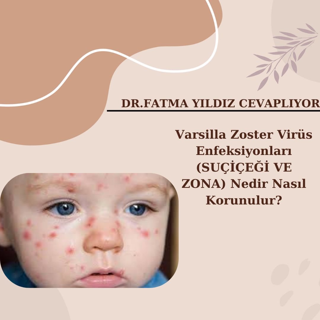 Varsilla/ Zoster/ Virüs/ Enfeksiyonları (SUÇİÇEĞİ VE ZONA) /Nedir ?Nasıl Korunulur?