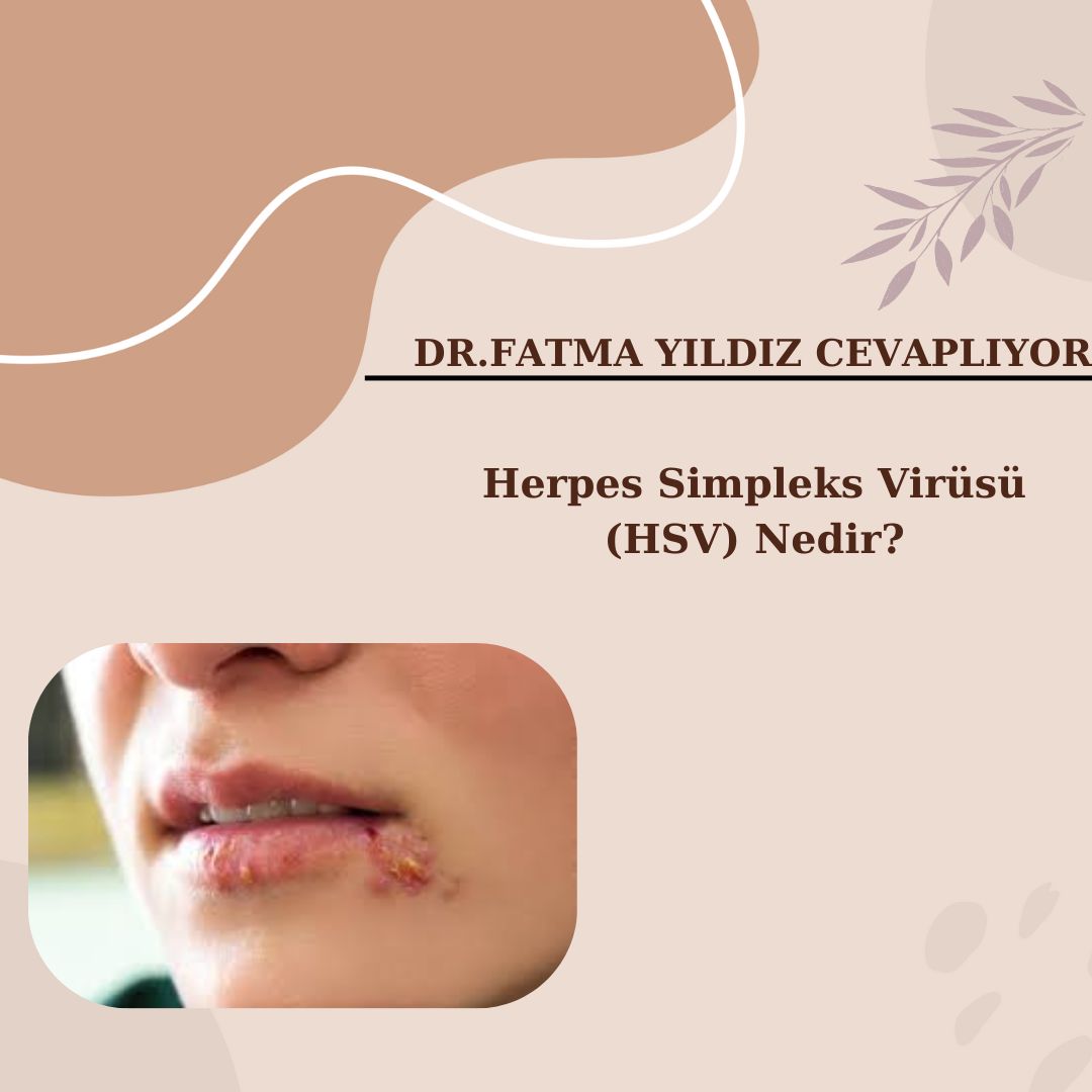 Herpes /Simpleks/ Virüsü/ (HSV) Nedir?