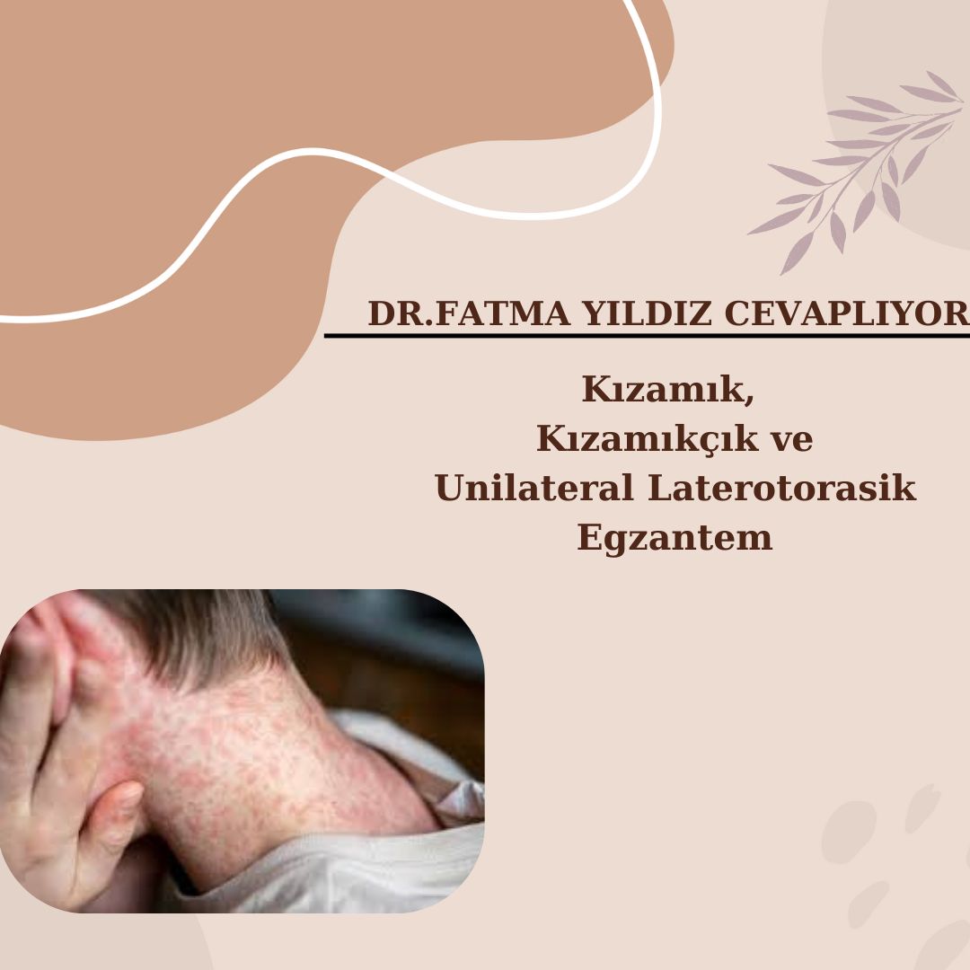 Kızamık/ Kızamıkçık/ Unilateral /Laterotorasik /Egzantem /Nedir? Tedavisi /Nasıl?
