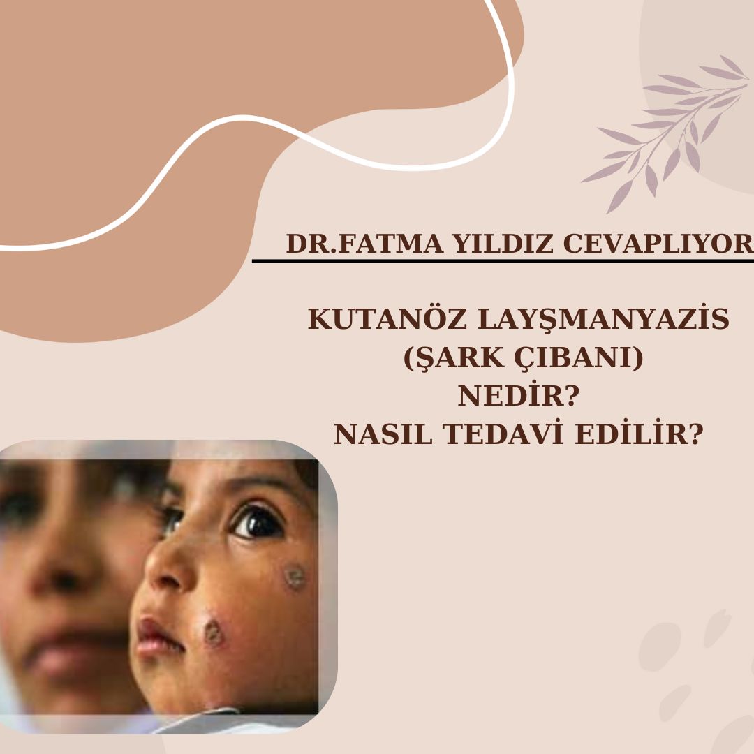 Şark Çıbanı /(Kutanöz) /Nedir / Nasıl/ Bulaşır?