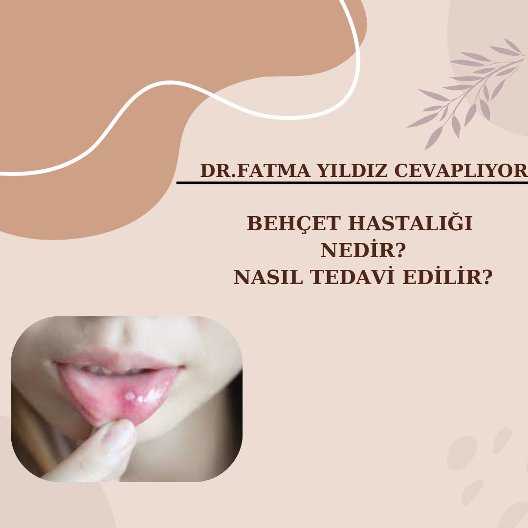Behçet /Hastalığı/ Nedir?