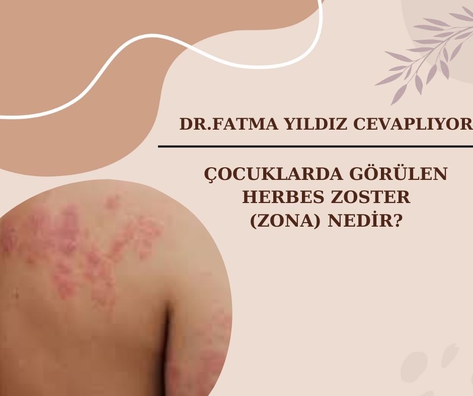 Çocuklarda-Görülen-Herpes-Zoster-(Zona)