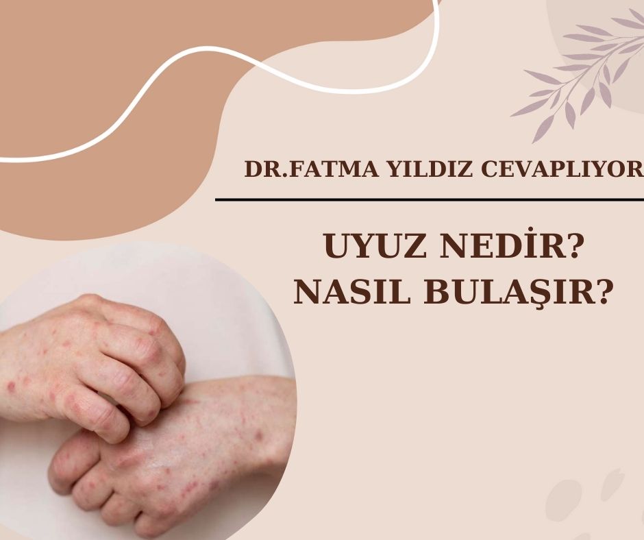 Uyuz/ Nedir/ ve Nasıl Bulaşır?