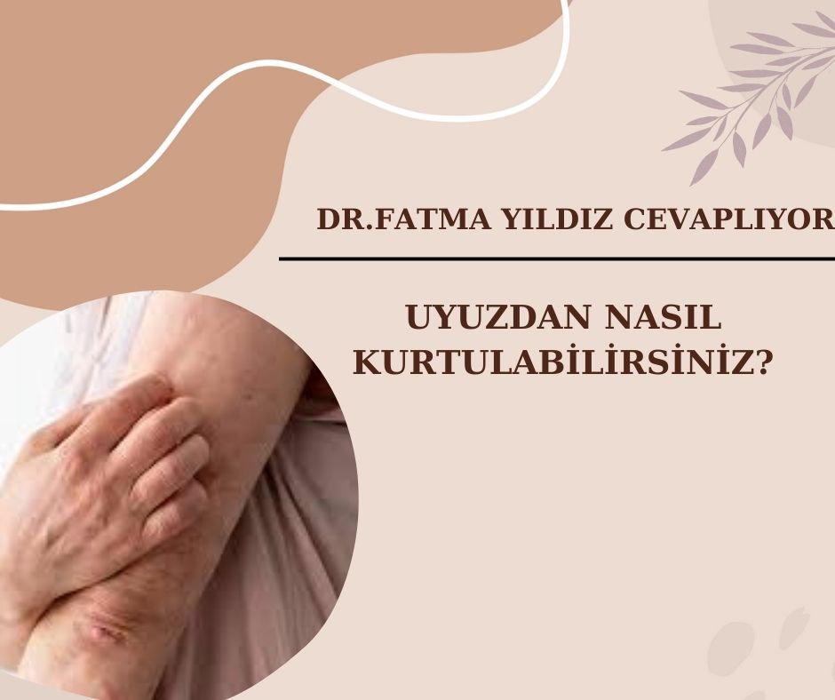  Uyuzdan Nasıl Kurtulabilirsiniz?