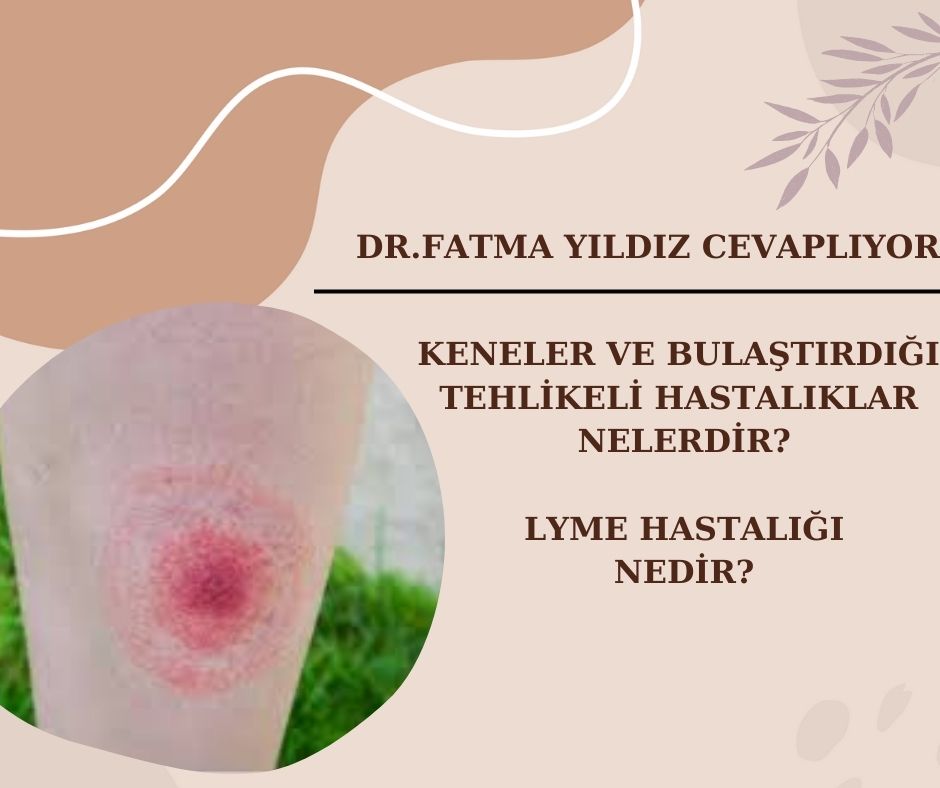 Keneler/ ve/ Bulaştırdığı/ Tehlikeli/ Hastalıklar /nelerdir? Lyme /Hastalığı /Nedir?
