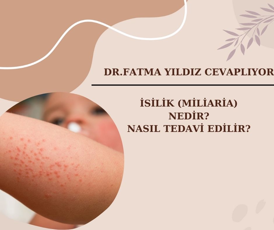 İsilik/ (Miliaria)/Nedir? Nasıl/ Tedavi/ Edilir?