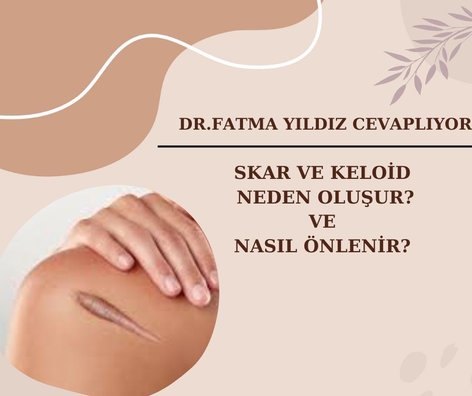 Skar ve Keloid Neden Oluşur ve Nasıl Önlenir?