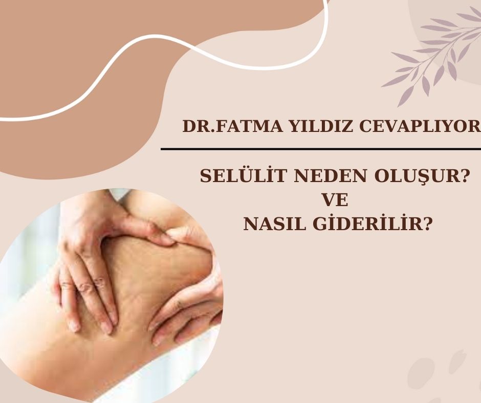 Selülit/ Neden/ Oluşur/ ve Nasıl/ Giderilir?