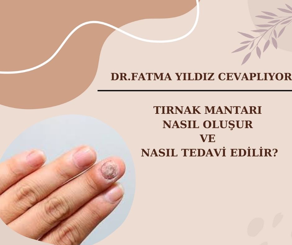 Tırnak Mantarı /Nasıl Oluşur/ ve Nasıl/ Tedavi Edilir?