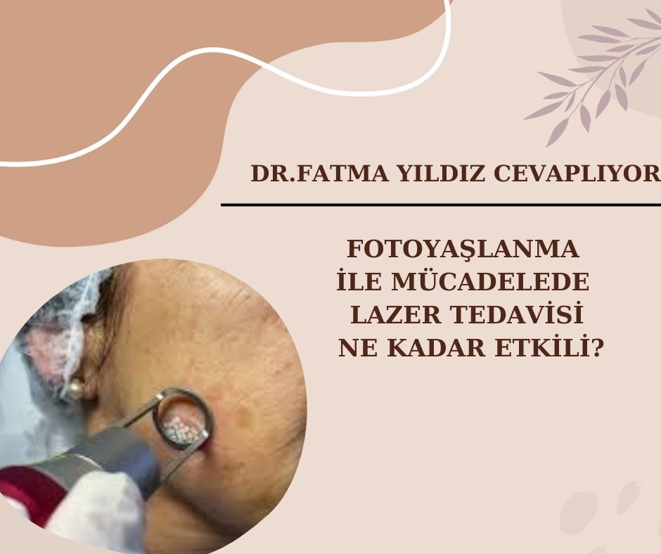 Fotoyaşlanma/ ile/ Mücadelede /Lazer Tedavisi /Ne Kadar Etkili?