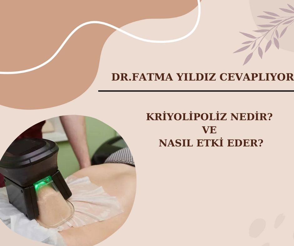 Kriyolipoliz Nedir/ ve Nasıl Etki Eder? 