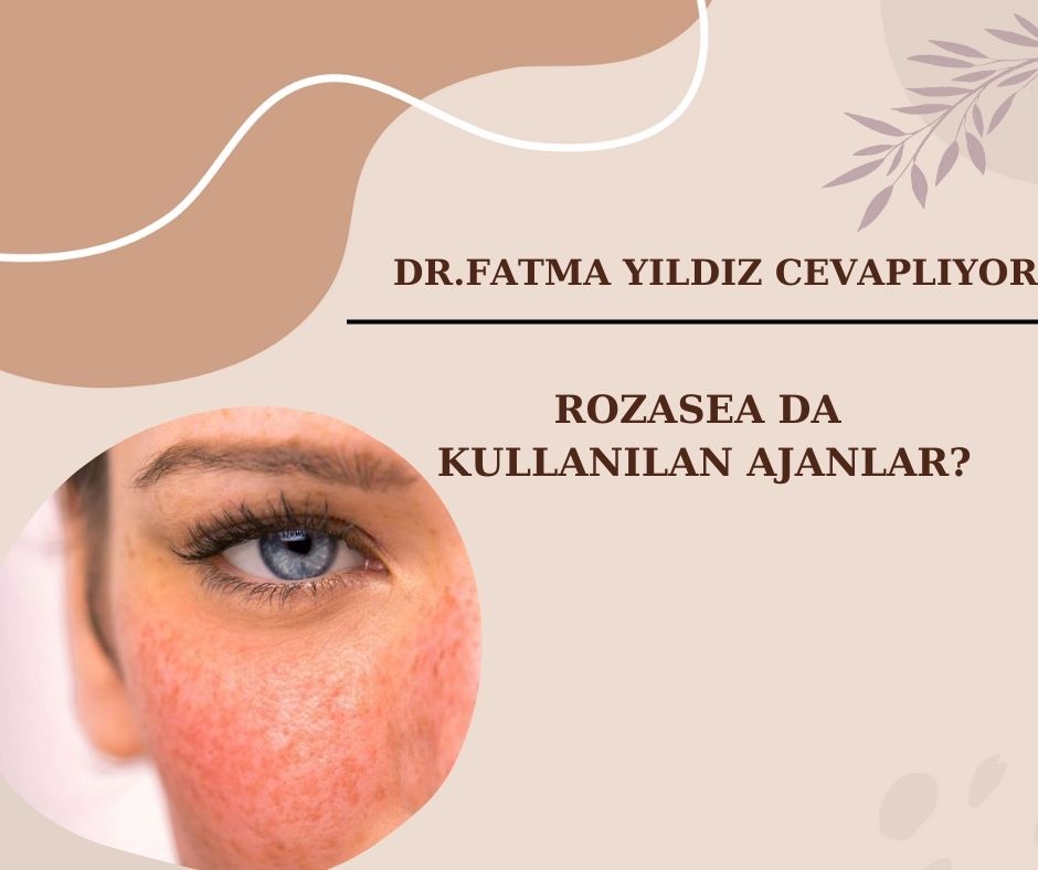 Rozasea Da Kullanılan Ajanlar?