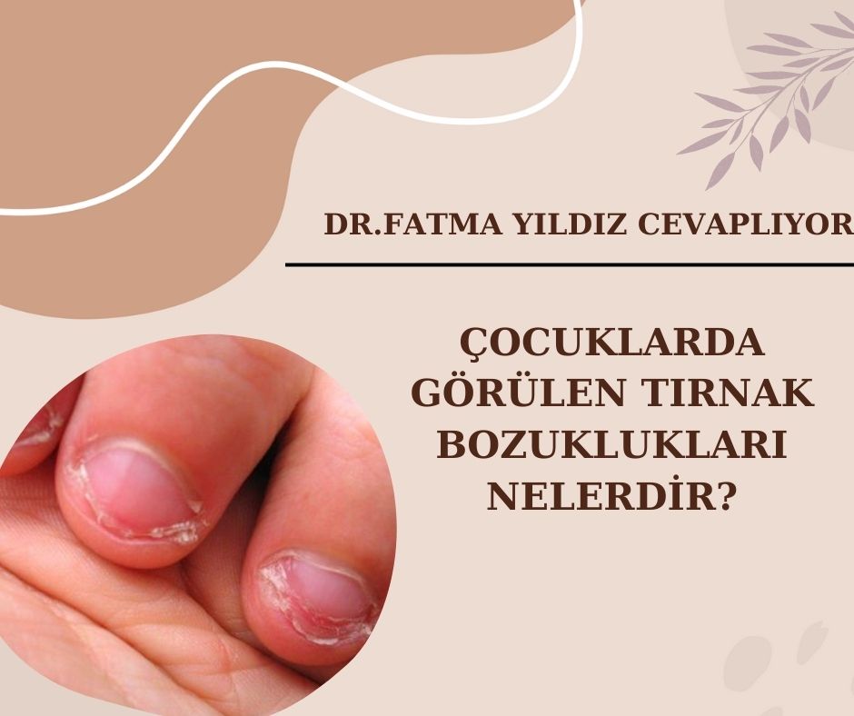 Çocuklarda Görülen/ Tırnak Bozuklukları/ Nelerdir?