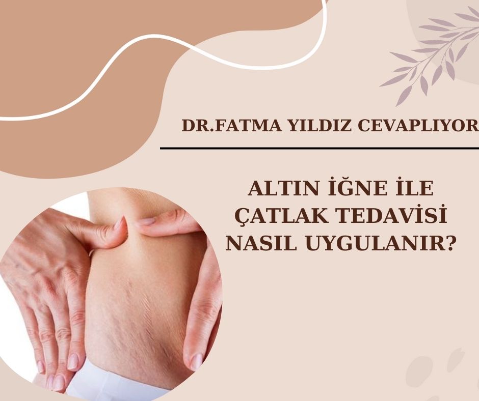 Altın İğne/ ile /Çatlak Tedavisi/ Nasıl Uygulanır?