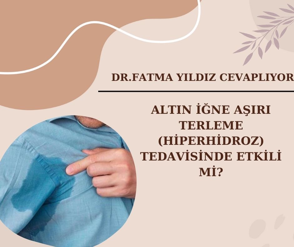  Altın İğne /Aşırı Terleme (Hiperhidroz)/ Tedavisinde Etkili mi?