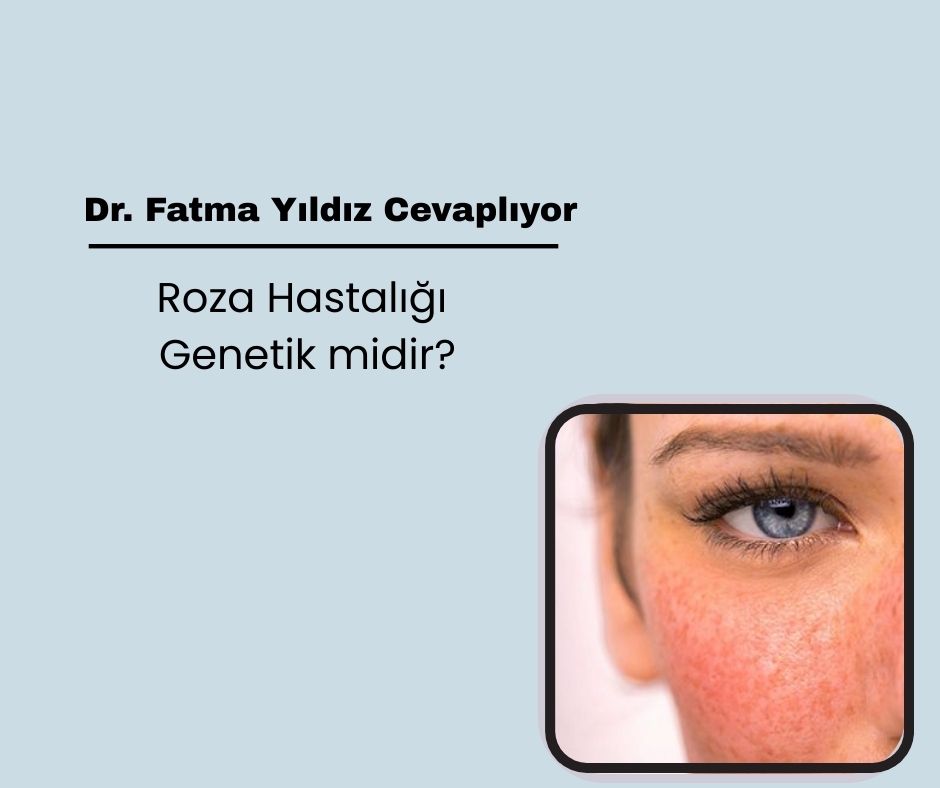 Roza Hastalığı (Rozasea) Neden Olur? Belirtileri ve Nedenleri