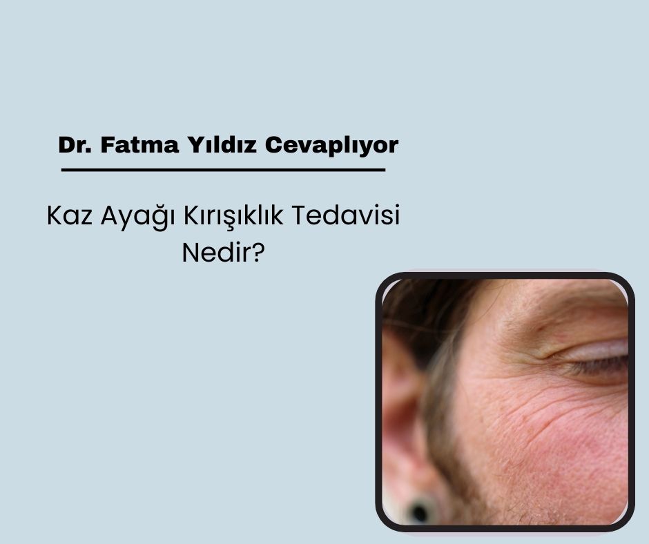 Kaz ayağı kırışıklık tedavisi