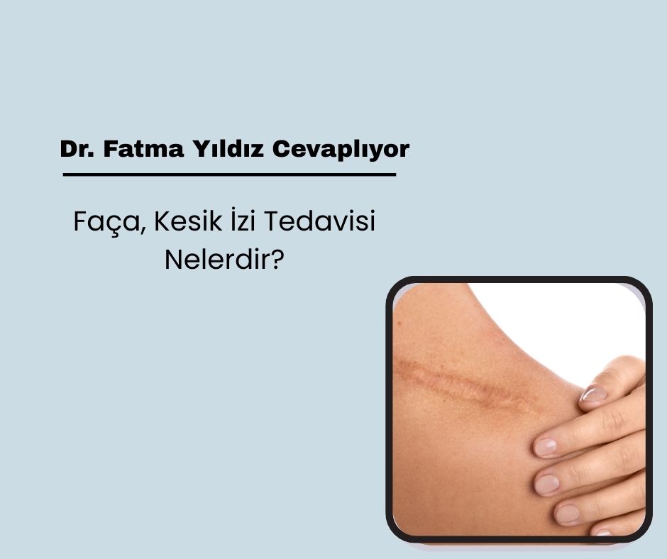 Faça, Kesik İzi Tedavisi