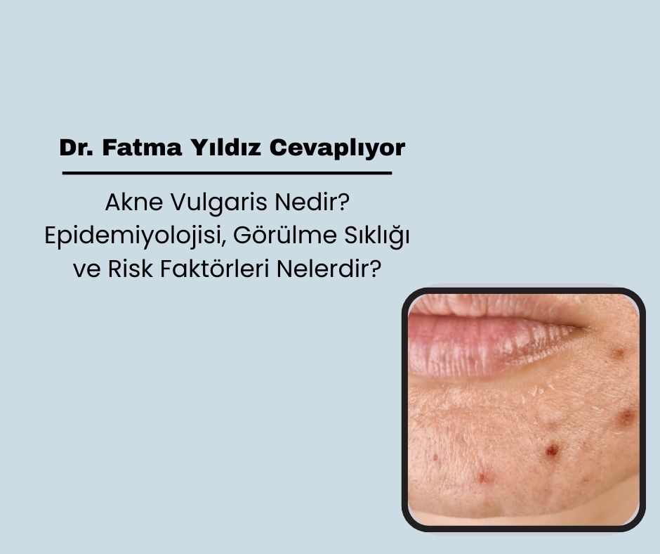 Akne Vulgaris Nedir? Epidemiyolojisi, Görülme Sıklığı ve Risk Faktörleri Nelerdir?
