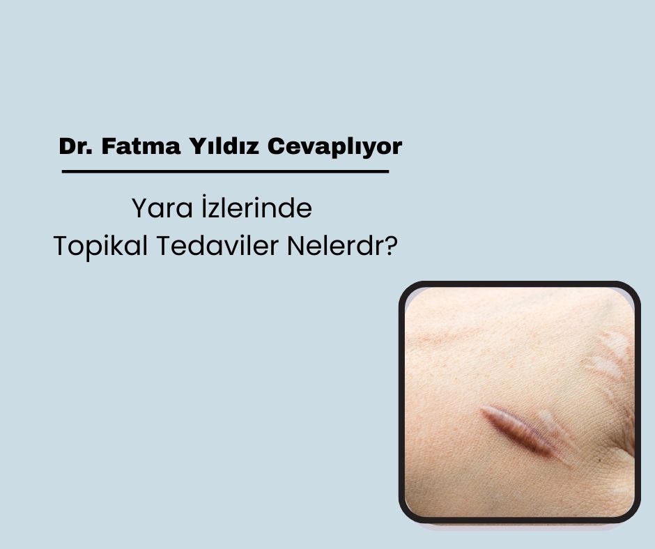 Topical Treatments for Scars