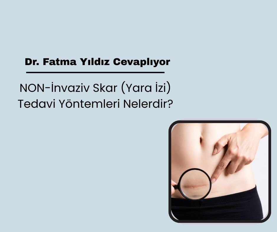NON-İnvaziv Skar (Yara İzi) Tedavi Yöntemleri Nelerdir?