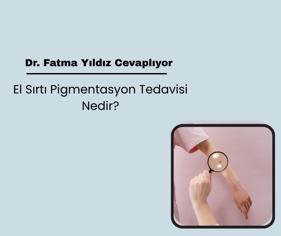El Sırtı Pigmentasyon Tedavisi Nedir?