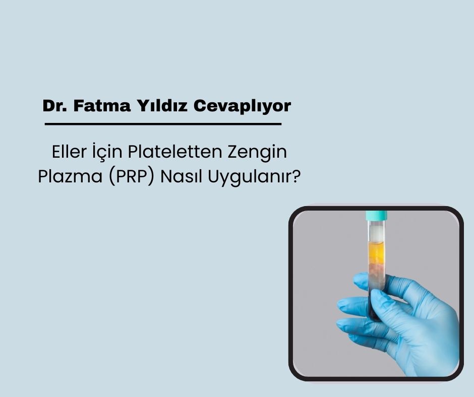 Eller İçin Plateletten Zengin Plazma (PRP) Nasıl Uygulanır?