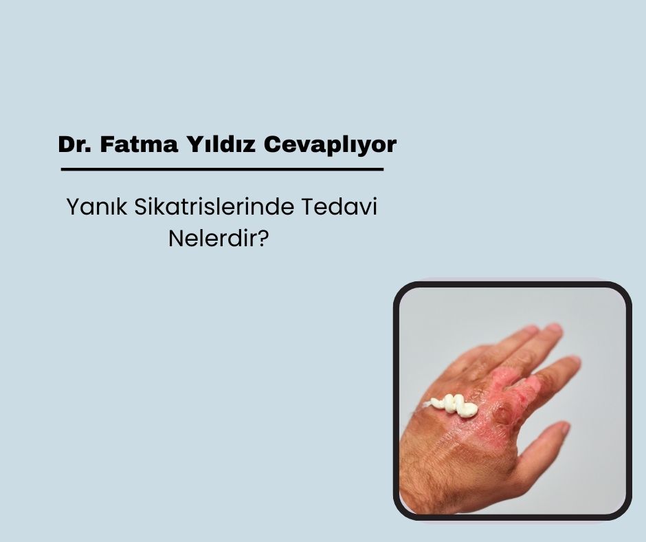 Yanık Sikatrislerinde Tedavi Nelerdir?