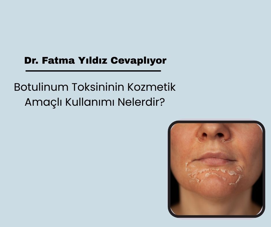 Kimyasal Soyma İşlemlerinde Görülen Komplikasyonlar Nelerdir?