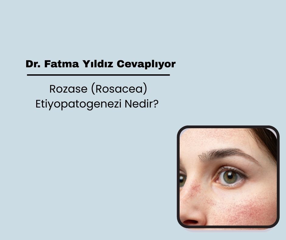 Rozase (Rosacea) Etiyopatogenezi Nedir?
