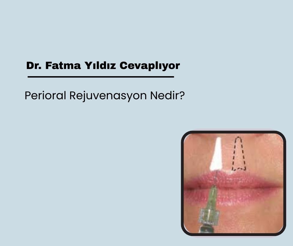 Perioral Rejuvenasyon Nedir?