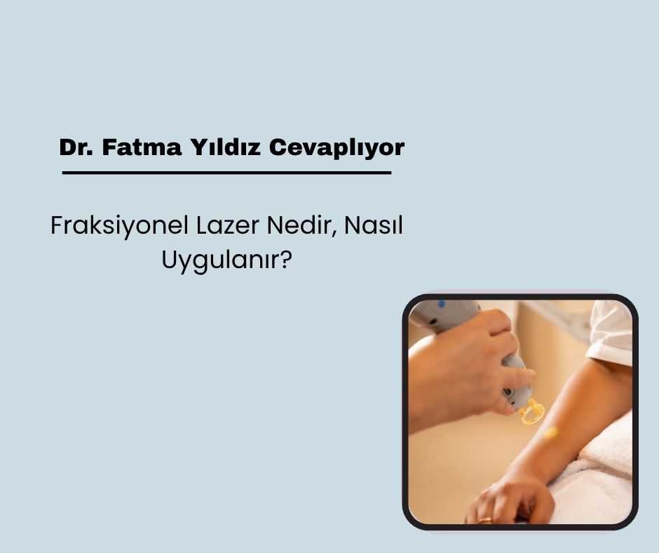 Fraksiyonel Lazer Nedir, Nasıl Uygulanır?