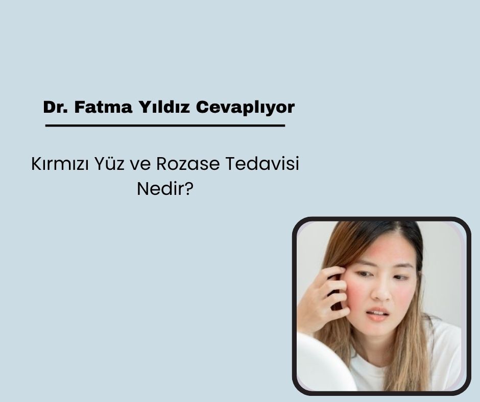 Kırmızı Yüz ve Rozase Tedavisinde Dermokozmetikler ve Kamuflajın Önemi Nedir?