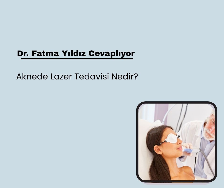 Aknede Lazer Tedavisi Nedir?