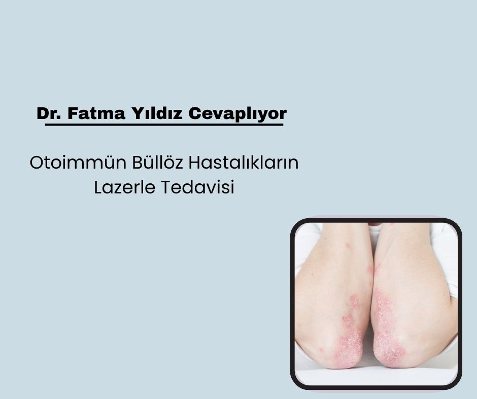 Otoimmün Büllöz Hastalıkların Lazerle Tedavisi