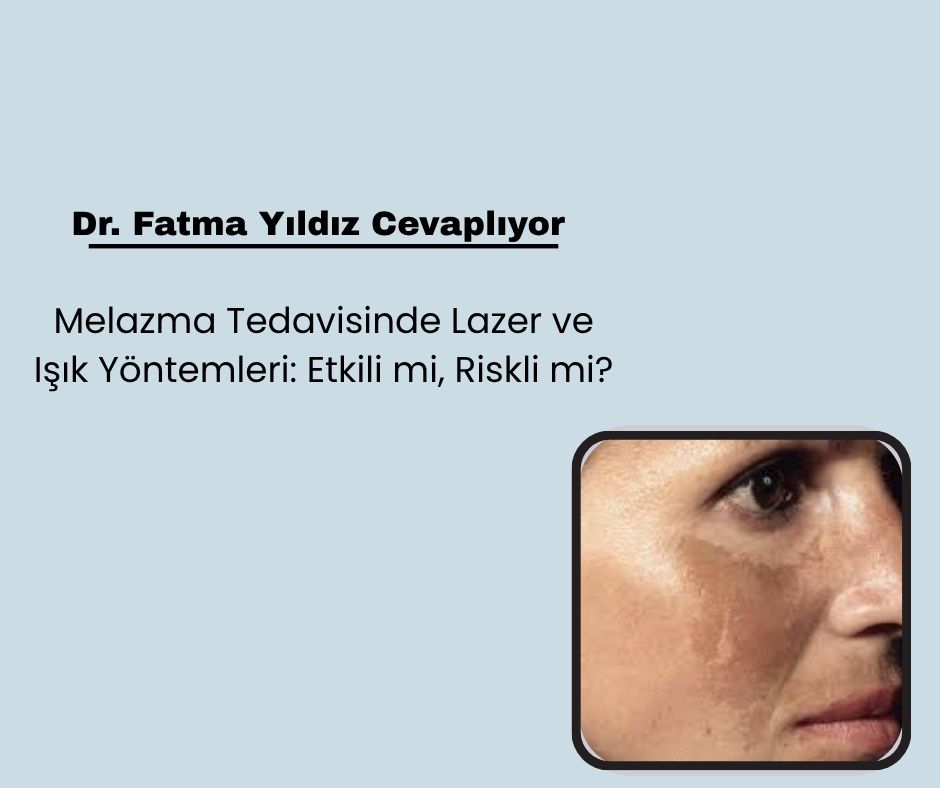 Melazma Tedavisinde Lazer ve Işık Yöntemleri: Etkili mi, Riskli mi?