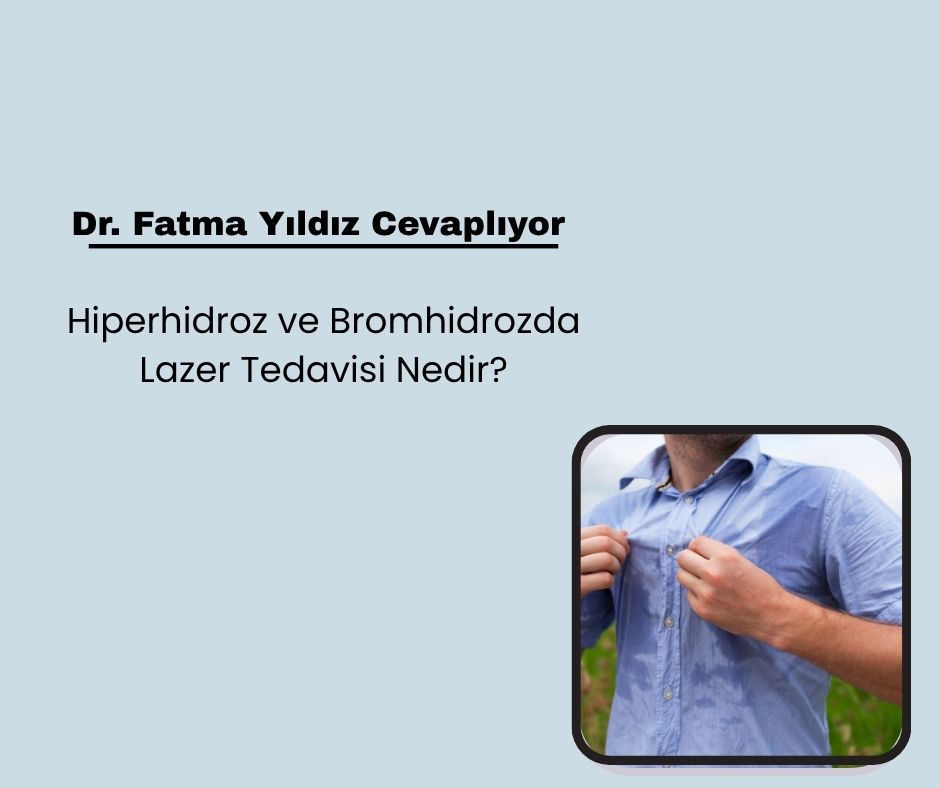 Hiperhidroz ve Bromhidrozda Lazer Tedavisi Nedir?