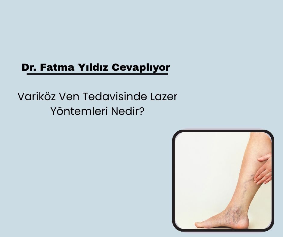 Variköz Ven Tedavisinde Lazer Yöntemleri Nedir?