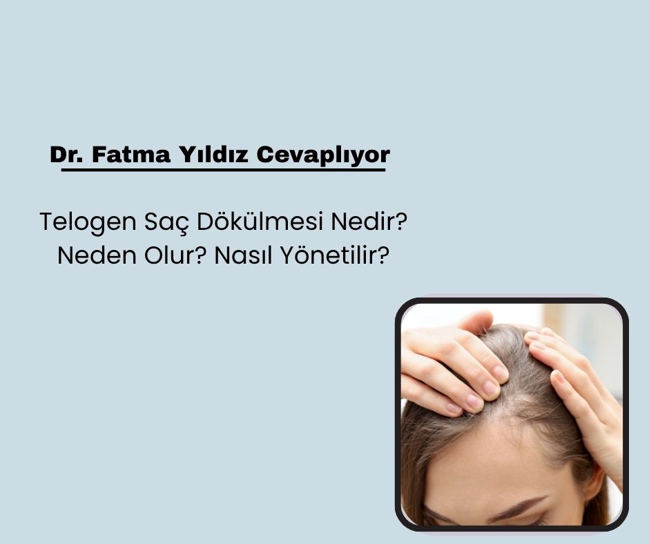 Telogen Saç Dökülmesi Nedir? Neden Olur? Nasıl Yönetilir?