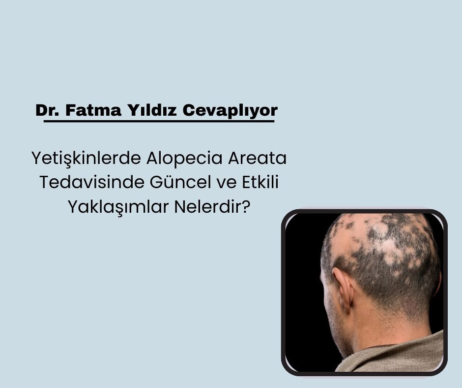 Yetişkinlerde Alopecia Areata Tedavisine Güncel Yaklaşımlar Nelerdir?